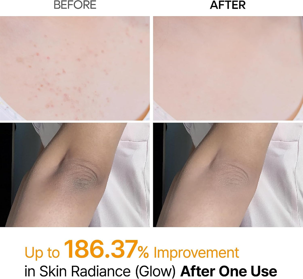 Dr.Melaxin Kojic Acid Turmeric Body Peeling Spray for Smooth Skin 200ml