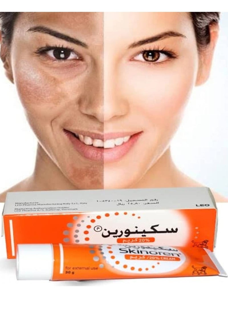 Anti Acne Treatment Cream 30g for Acne-Prone Skin in UAE